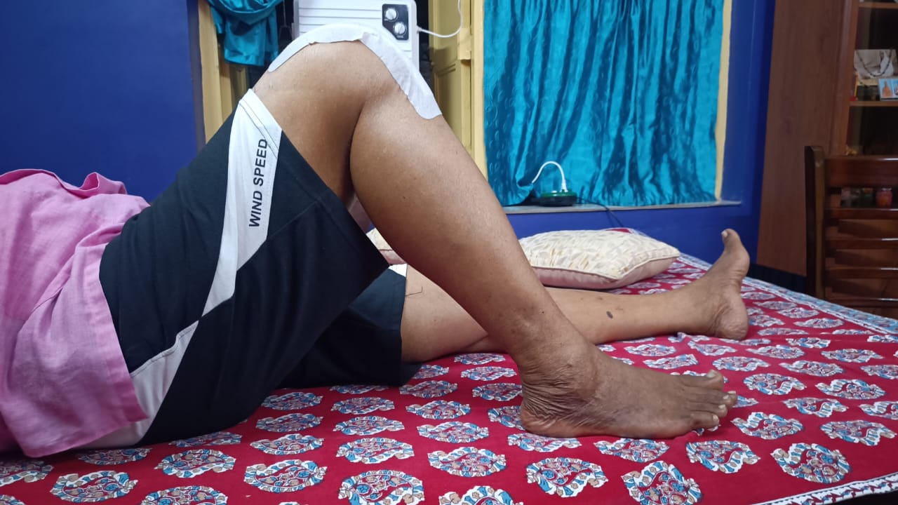 TKR THR Rehabilitation